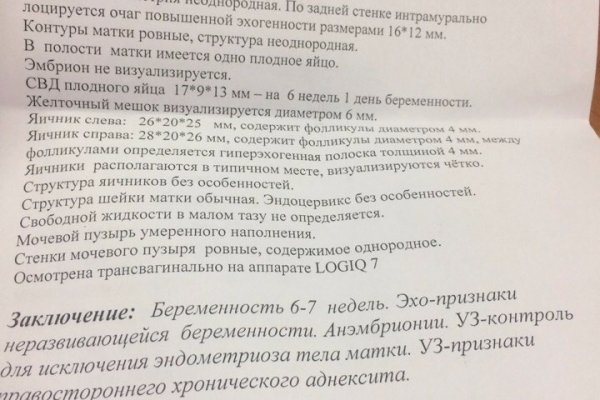 Kra32.gl